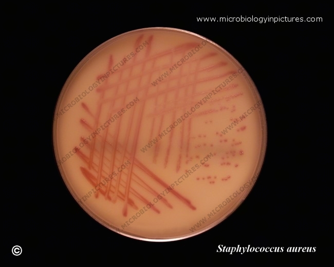 methicillin resistant Staphylococcus aureus (MRSA)